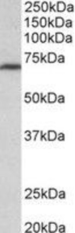 MTHFR Antibody, Novus Biologicals 0.1mg; Unlabeled:Antibodies, Polyclonal