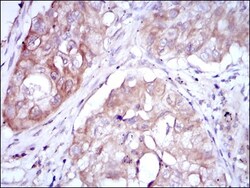 MTHFR Antibody (5D3), Novus Biologicals 0.1mL; Unlabeled:Antibodies, Monoclonal