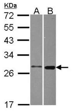 MTHFS Antibody, Novus Biologicals 0.1mL; Unlabeled:Antibodies, Polyclonal