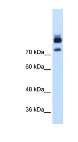 MTMR1 Antibody, Novus Biologicals 100 &mu;L | Buy Online | Novus Biologicals | Fisher Scientific