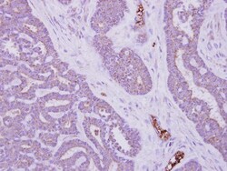 MTMR14 Antibody, Novus Biologicals 0.1mg; Unlabeled:Antibodies, Polyclonal