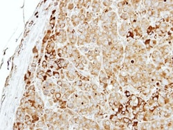 MTMR14 Antibody, Novus Biologicals 0.1mL; Unlabeled:Antibodies, Polyclonal