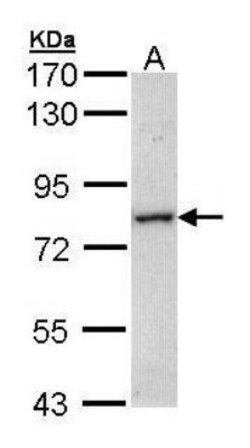 MTMR14 Antibody, Novus Biologicals 0.1mg; Unlabeled:Antibodies, Polyclonal