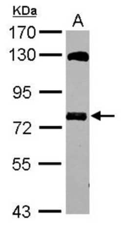 MTMR14 Antibody, Novus Biologicals 0.1mL; Unlabeled:Antibodies, Polyclonal