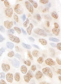 MTMR15 Antibody, Novus Biologicals 0.1mL; Unlabeled:Antibodies, Polyclonal