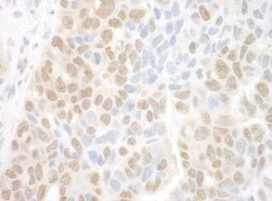 MTMR15 Antibody, Novus Biologicals 0.1mL; Unlabeled:Antibodies, Polyclonal