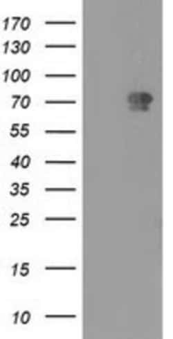 MTMR2 Antibody (OTI2D2), Novus Biologicals 0.1mL; Unlabeled:Antibodies,