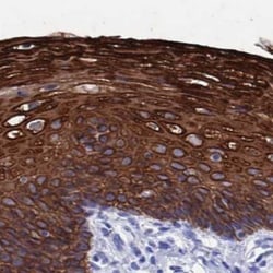 MTMR2 Antibody, Novus Biologicals:Antibodies:Primary Antibodies