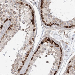 MTMR3 Antibody, Novus Biologicals 25 &mu;L; Unlabeled:Antibodies, Polyclonal