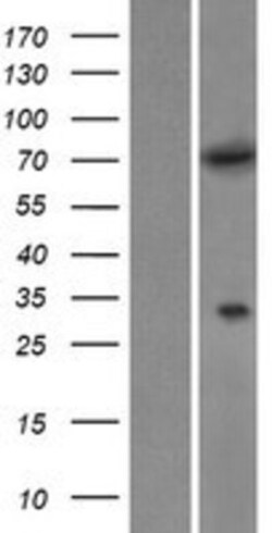 Novus Biologicals&trade;&nbsp;MTMR6 Overexpression Lysate