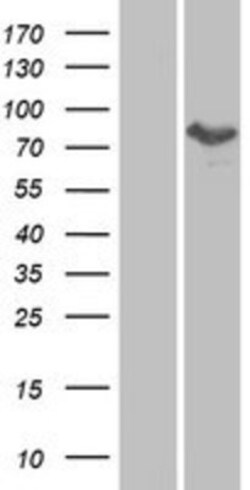 Novus Biologicals&trade;&nbsp;MTMR8 Overexpression Lysate