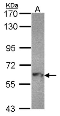 MTMR9 Antibody, Novus Biologicals 0.1 mL | Buy Online | Novus Biologicals | Fisher Scientific