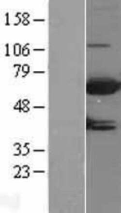 Novus Biologicals&trade;&nbsp;MTMR9 Overexpression Lysate