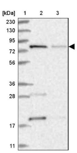 MTO1 Antibody, Novus Biologicals 0.1mL; Unlabeled:Antibodies, Polyclonal