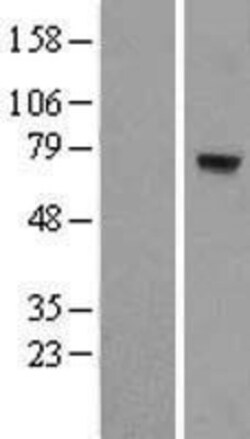 Novus Biologicals&trade;&nbsp;MTO1 Overexpression Lysate