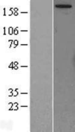 Novus Biologicals&trade;&nbsp;TOR/mTOR Overexpression Lysate