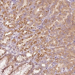 MTR120 Antibody, Novus Biologicals:Antibodies:Primary Antibodies