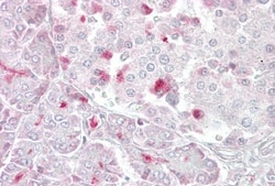 MTR Antibody, Novus Biologicals 100&mu;L; Unlabeled:Antibodies, Polyclonal
