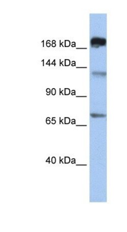 MTR Antibody, Novus Biologicals 100&mu;L; Unlabeled:Antibodies, Polyclonal