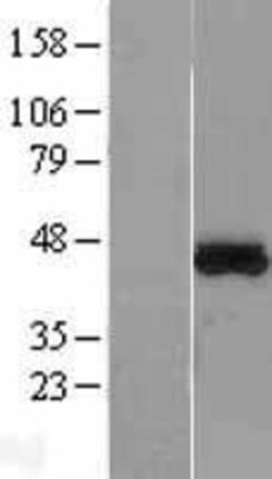 Novus Biologicals&trade;&nbsp;MTRF1L Overexpression Lysate