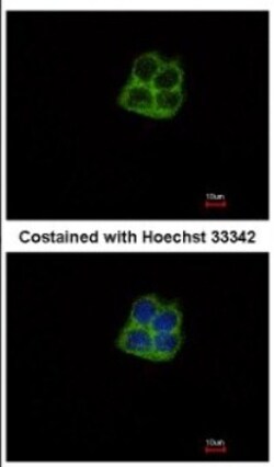 mtRNA polymerase Antibody, Novus Biologicals 0.1mL; Unlabeled:Antibodies,