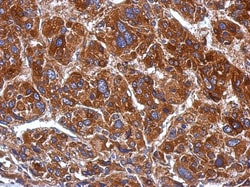 mtRNA polymerase Antibody, Novus Biologicals 0.1mL; Unlabeled:Antibodies,