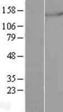 Novus Biologicals&trade;&nbsp;mtRNA polymerase Overexpression Lysate