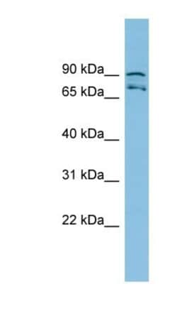 MTRR Antibody, Novus Biologicals:Antibodies:Primary Antibodies