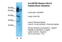 MTRR Antibody, Novus Biologicals:Antibodies:Primary Antibodies