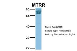 MTRR Antibody, Novus Biologicals:Antibodies:Primary Antibodies
