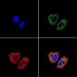 mtTFA Antibody (18G102B2E11), Novus Biologicals 0.025 mL | Buy Online | Novus Biologicals | Fisher Scientific