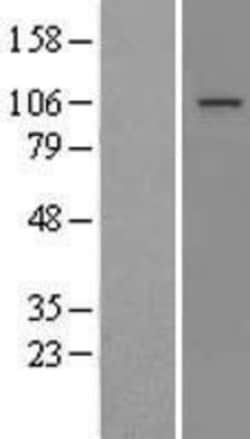 Novus Biologicals&trade;&nbsp;MTTP Overexpression Lysate