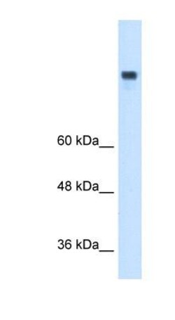 MTTP Antibody, Novus Biologicals 0.05mg; Unlabeled:Antibodies, Polyclonal