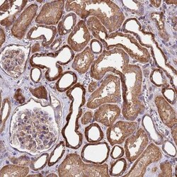 MTX3 Antibody, Novus Biologicals 0.1mL; Unlabeled:Antibodies, Polyclonal