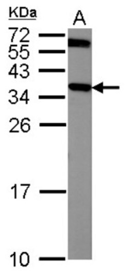 mu Crystallin Antibody, Novus Biologicals 0.1mL; Unlabeled:Antibodies,