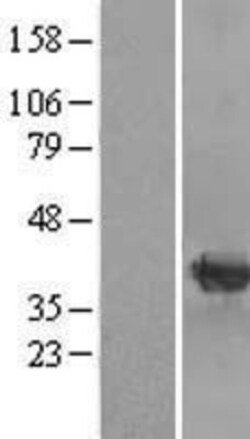 Novus Biologicals&trade;&nbsp;mu Crystallin Overexpression Lysate