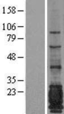Novus Biologicals&trade;&nbsp;MUC1 Overexpression Lysate
