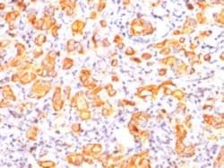 MUC1 Antibody (GP1.4), Novus Biologicals:Antibodies:Primary Antibodies