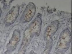 MUC1 Antibody - BSA Free, Novus Biologicals 0.1mg; Unlabeled:Antibodies,