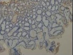 MUC1 Antibody - BSA Free, Novus Biologicals 0.1mg; Unlabeled:Antibodies,