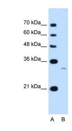 MUC3B Antibody, Novus Biologicals:Antibodies:Primary Antibodies