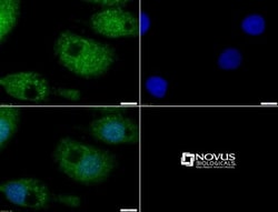 MUC4 Antibody, Novus Biologicals:Antibodies:Primary Antibodies