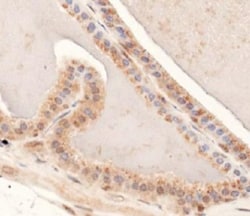 MUC4 Antibody, Novus Biologicals:Antibodies:Primary Antibodies