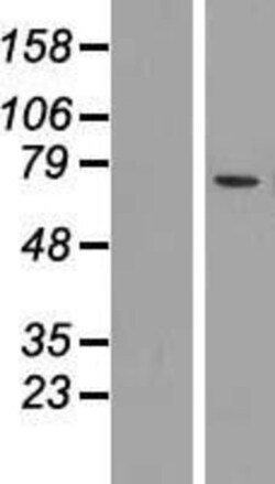 Novus Biologicals&trade;&nbsp;Mucolipin 2 Overexpression Lysate