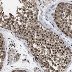 Mucolipin 2 Antibody, Novus Biologicals 0.1mL; Unlabeled:Antibodies, Polyclonal