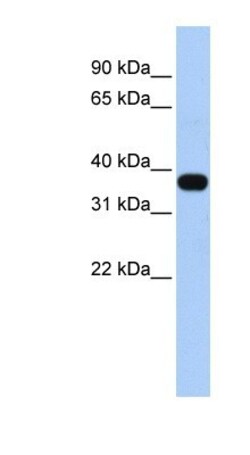 MUL1 Antibody, Novus Biologicals 0.05mg; Unlabeled:Antibodies, Polyclonal