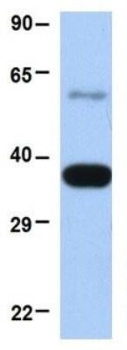 MUL1 Antibody, Novus Biologicals 0.05mg; Unlabeled:Antibodies, Polyclonal