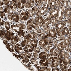 MUM1L1 Antibody, Novus Biologicals 25 &mu;L; Unlabeled:Antibodies, Polyclonal