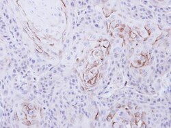 mu Opioid R/OPRM1 Antibody, Novus Biologicals 0.1mL; Unlabeled:Antibodies,