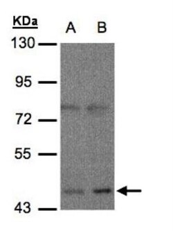mu Opioid R/OPRM1 Antibody, Novus Biologicals 0.1mL; Unlabeled:Antibodies,